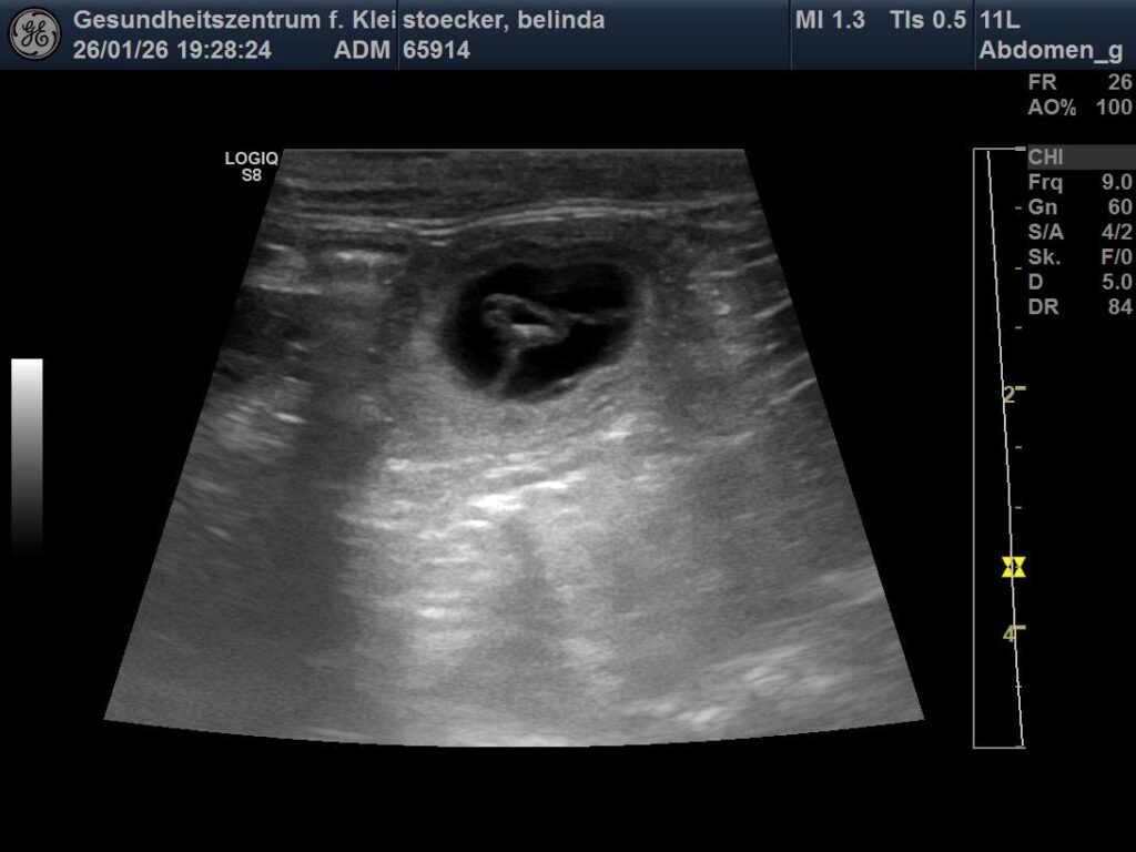 Ultraschalbild von Belinda Ende Januar 2026