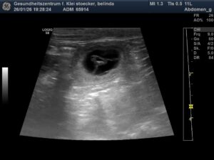 Ultraschalbild von Belinda Ende Januar 2026